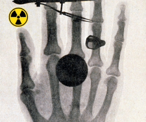 zasady ochrony radiologicznej